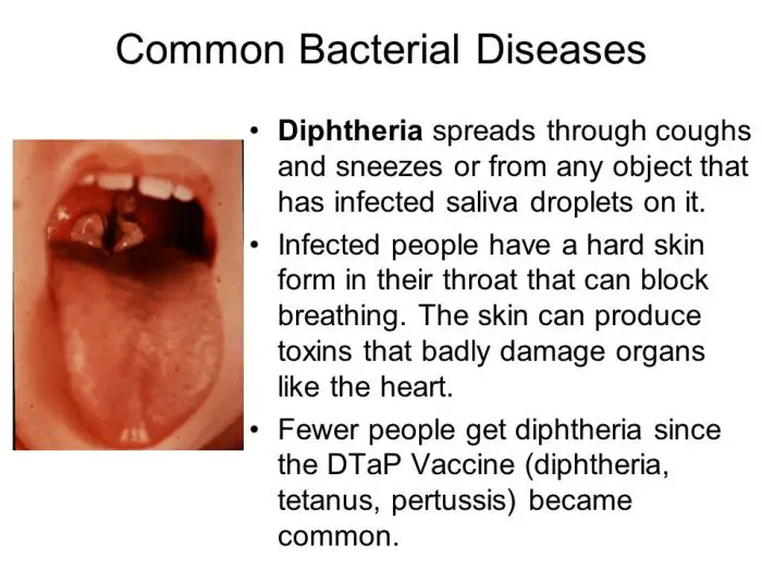 Diphtheria