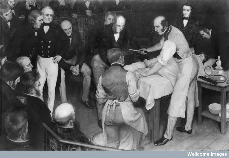 Robert Liston operating. Credit: Wellcome Library, London. 