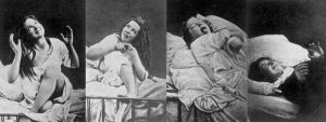 Female hysteria symptoms
